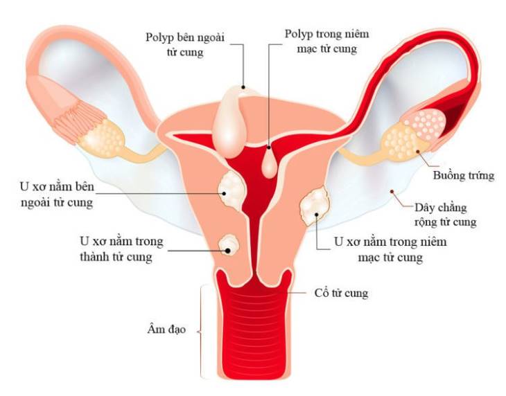 Trinh nữ hoàng cung chữa bệnh gì ? có tác dụng phụ không?