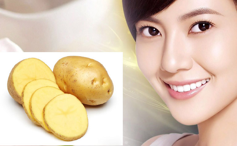 Trị mề đay bằng khoai tây rất an toàn và lành tính