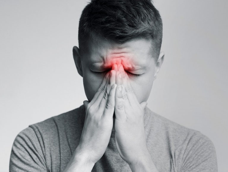 Viêm xoang mãn tính là một trong những nguyên nhân gây bệnh viêm họng mãn tính