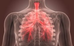 Viêm phế quản là bệnh lý về đường hô hấp xảy ra khá phổ biến