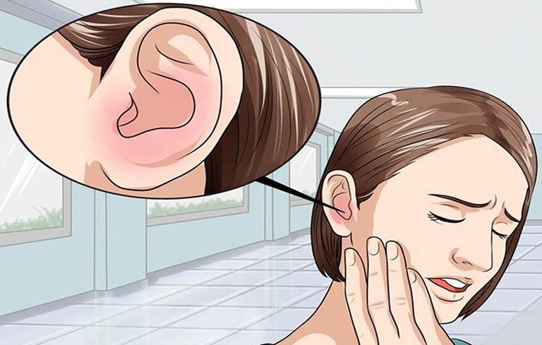 Đau đầu ù tai cảnh báo bệnh rối loạn tiền đình