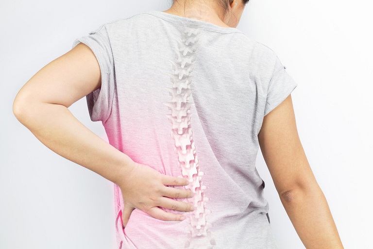 Thoái hóa cột sống thắt lưng là bệnh xương khớp mạn tính