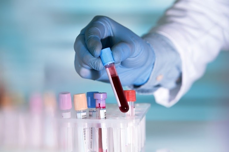 Xét nghiệm máu có thể giúp chẩn đoán bệnh chính xác