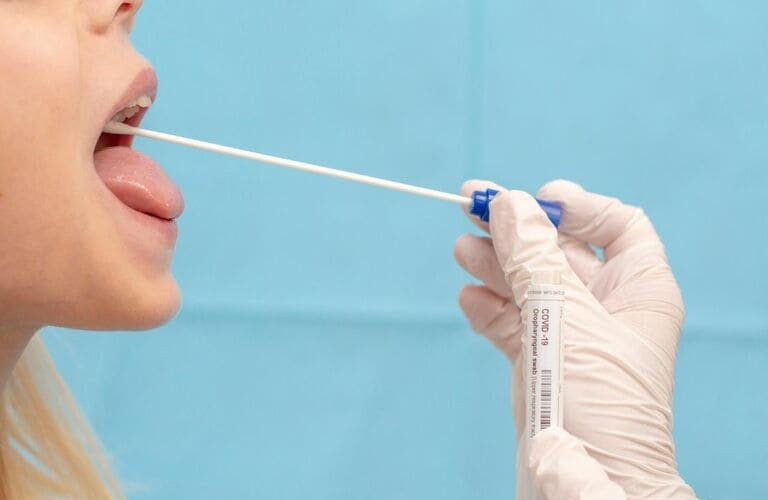 Lấy mẫu dịch họng để xét nghiệm kiểm tra xem có sự tồn tại của vi khuẩn, virus gây viêm VA là cách chẩn đoán phổ biến nhất