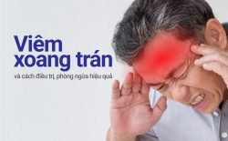 Viêm xoang trán là bệnh tai mũi họng phổ biến