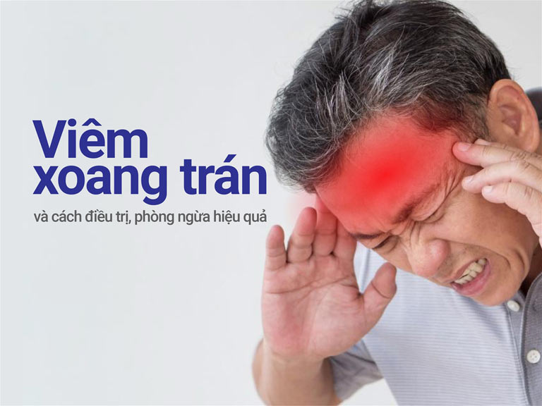 Viêm xoang trán là bệnh tai mũi họng phổ biến