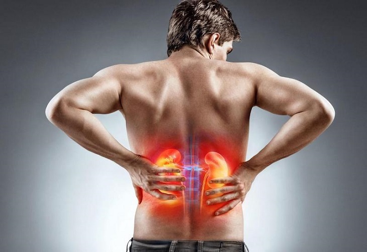 Triệu chứng điển hình của sỏi thận là đau lưng dữ dội 