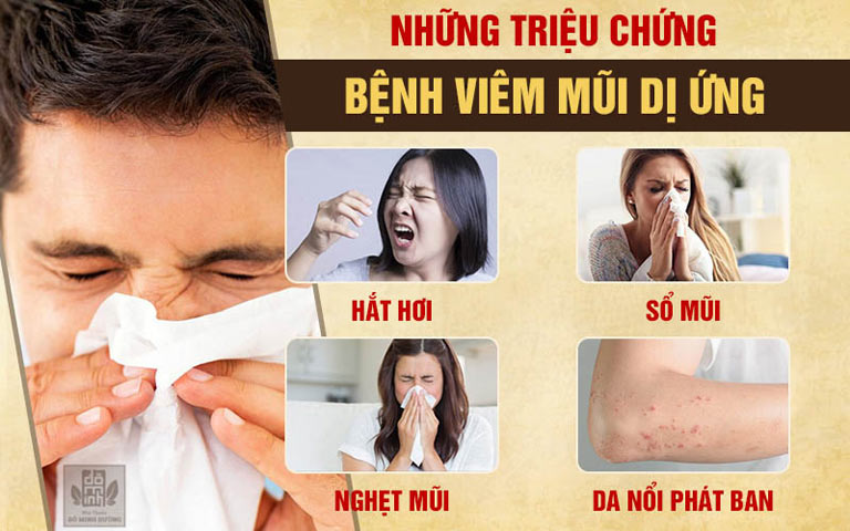 Một số triệu chứng bệnh viêm mũi dị ứng