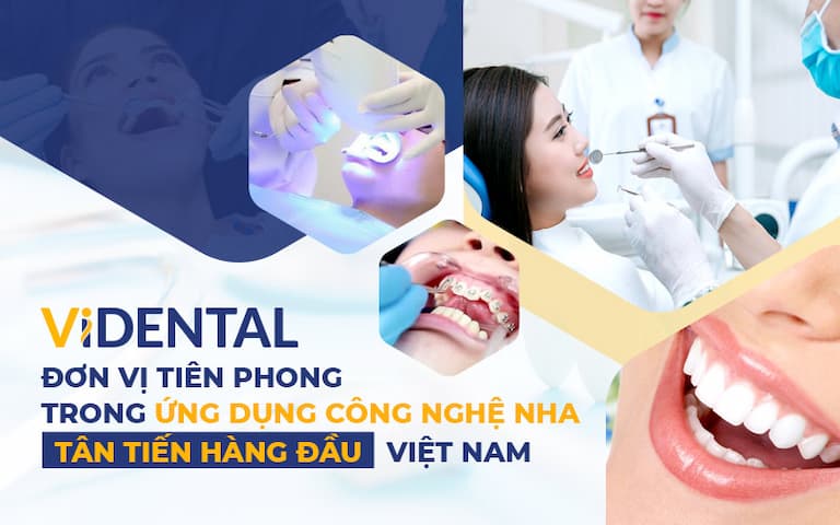 Vidental là đơn vị tiên phong ứng dụng công nghệ nha khoa tân tiến hàng đầu Việt Nam